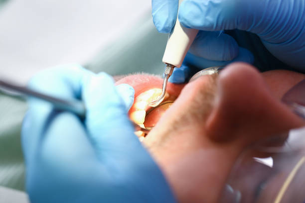 Best Emergency Care for Gum Disease in Holmen, WI